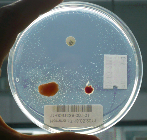 Je ein Stück Muskel und Niere sowie ein Antibiotika-beschicktes Testplättchen (Positivkontrolle) auf einer Hemmstoffplatte bei pH 6.0.