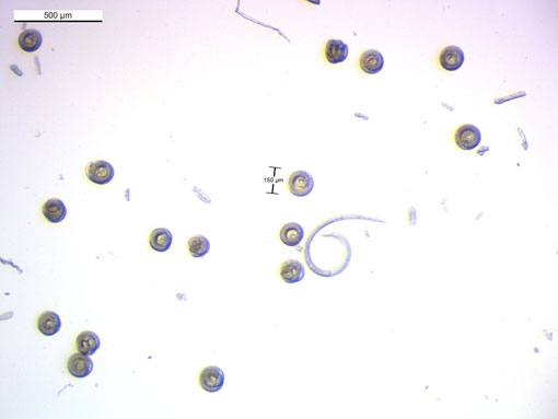 Abbildung 3: Mikroskopaufnahme mit Größenvergleich