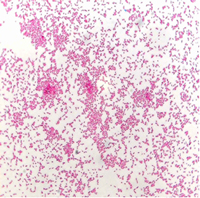 VTEC unter dem Mikroskop (gram-negative Stäbchenbakterien)