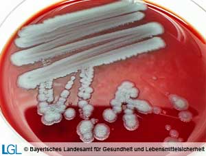 Kolonien von Bacillus anthracis auf Blutagar.