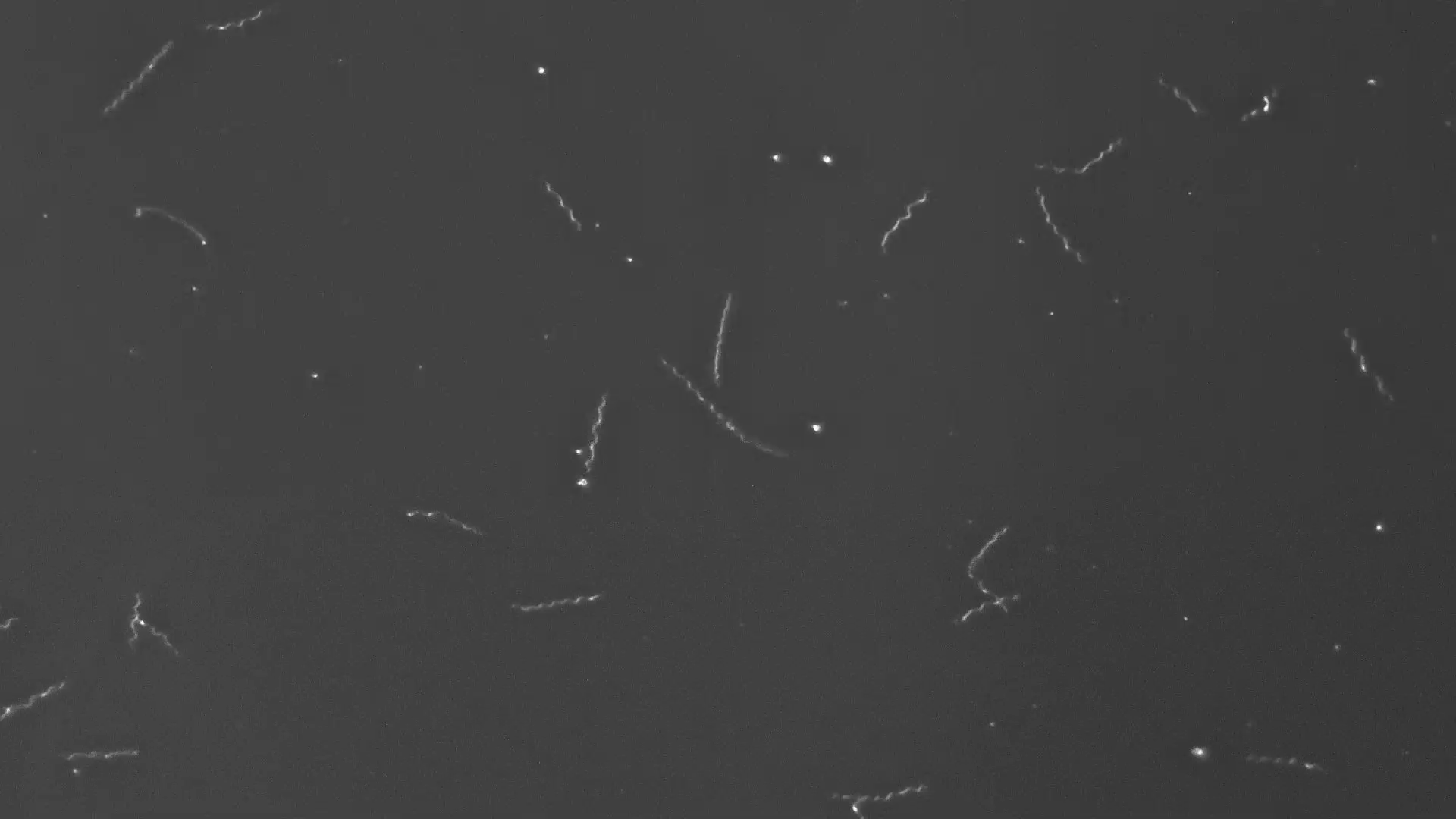 Erreger der Lyme-Borreliose unter dem Mikroskop