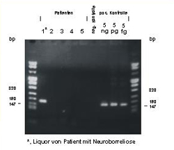 Agarosegel der PCR Produkte