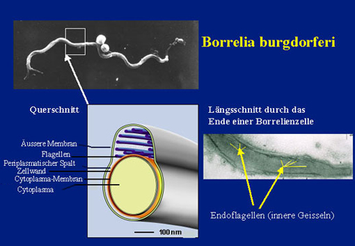 Abbildung: Anatomie der Borrelia Burgdorferi; Längsschnitt durch das Ende einer Borrelienzelle mit Endoflagellen (innere Geisseln); Querschnitt mit: Äußere Membran, Flagellen, Periplasmischer Spalt, Zellwand, Cytoplasma Membran, Cytoplasma