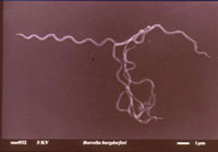 Abbildung: Rasterelekotronenmikoskopie