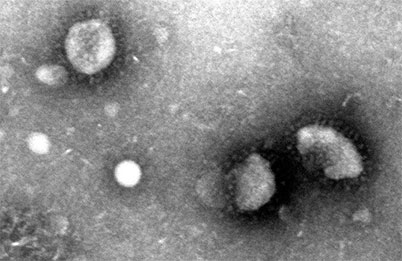 Extrem vergrößerte elektronmikrospische Darstellungvon drei nebeneinanderliegenden  Coronaviren