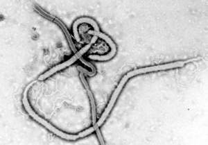 Elektronenmikroskopische Aufnahme eines Ebolavirus
