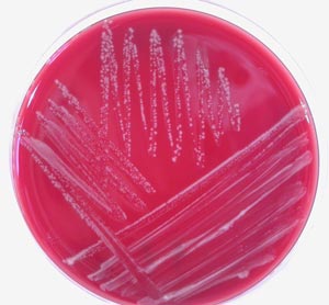Campylobacter spp.