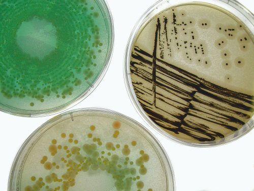 3 Petrischalen mit verschiedenen Keimen