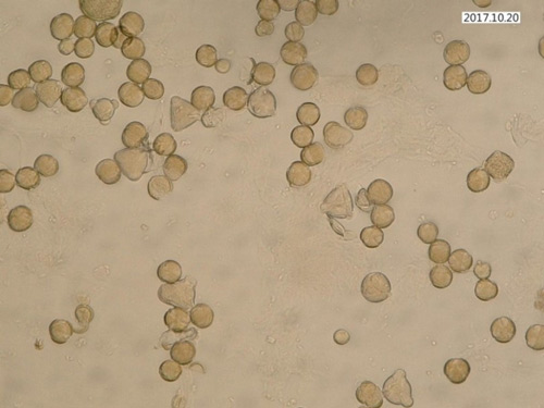 Abbildung 1 zeigt ein mikroskopisches Pollenbild mit Raps- und Obstblütenpollen.