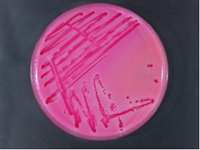 Salmonellenkultur auf Rambach-Agar (pinkfarbene Kolonien auf rosa Selektivagar)
