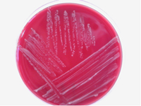 Thermophile Campylobacter spp. auf Blutagar