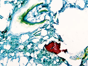 Histologische Mikroskopaufnahme