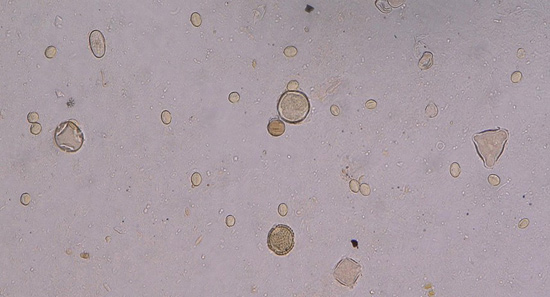 Diese Abbildung zeigt eine Mikroskopaufnahme von Pollen 