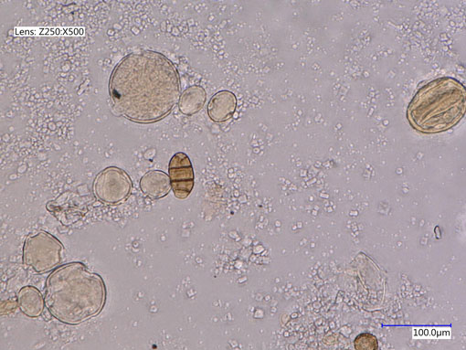 Diese Abbildung zeigt eine Mikroskopaufnahme von Pollen und einem braunen Pilzelement