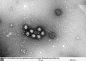 Aufnahme von SARS-CoV-2 Viren mit dem Elektronenenmikroskop