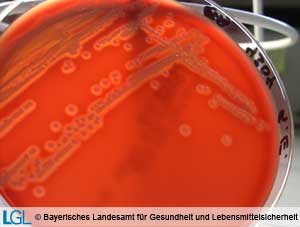 hämolysierende Escherichia coli auf Blutagar.