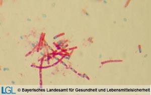 Bacillus anthracis (Endosporen grün, Bakterienzellen rot), Sporenfärbung nach Rakette.