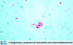 Mycobacterium avium subsp. paratuberculosis in typischer Lagerung (Ziehl-Neelsen-Färbung, Kot Rind).