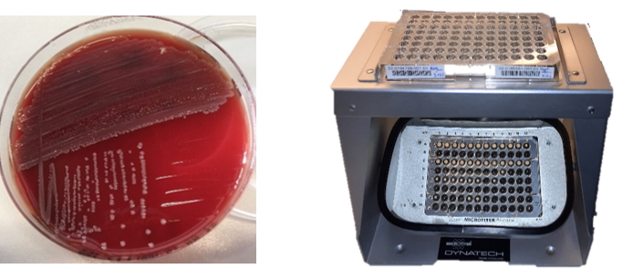 Links ist eine runde, mit rotem Blutagar gefüllte Schale und darauf wachsenden Bakterienkolonien zu sehen. Rechts ist eine Apparatur zu erkennen, auf der eine Platte mit 96 Vertiefungen liegt. Um mögliches Bakterienwachstum in jeder der Vertiefungen beurteilen zu können ist ein schräg aufgehängter Spiegel darunter angebracht. Im Spiegel sind bewachsene Vertiefungen mit bräunlicher Färbung zu erkennen. Nicht bewachsene Vertiefungen sind optisch schwarz.
