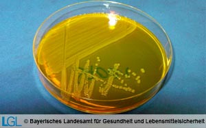 Laktosenegative Salmonella-Kolonien auf Gassneragar
