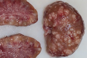 Auf der Abbildung sind zwei Nieren eines an Tularämie verendeten Feldhasen zu erkennen. Bei einer Niere sieht man die Oberfläche, bei der zweiten Niere die Schnittfläche. In beiden Nieren sind zahlreiche weißgelbe, wenige Millimeter große Herde zu erkennen, die über die Nierenoberfläche hinausragen. Es handelt sich um Abszesse bzw. Granulome, die Ausdruck eines länger andauernden (chronischen) Krankheitsgeschehen sind.