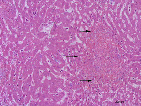 Die Abbildung stellt eine mikroskopische Aufnahme einer mit Hämatoxylin-Eosin gefärbten Leber eines Feldhasen mit Tularämie dar. Im Lebergewebe ist ein durch die Francisellen verursachter Nekroseherd (Gewebsuntergang) erkennbar. In der Nekrosezone ist die typische Leberbälkchenstruktur aufgehoben.
