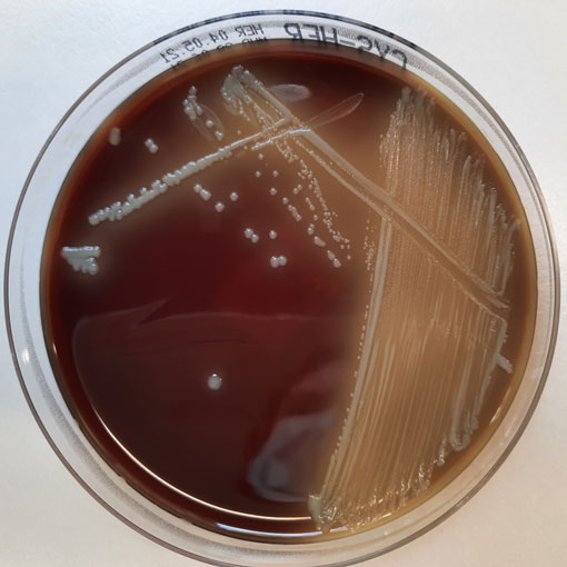 Petrischale mit dem einer bakteriologischen Kultur von Frandiselle tularensis