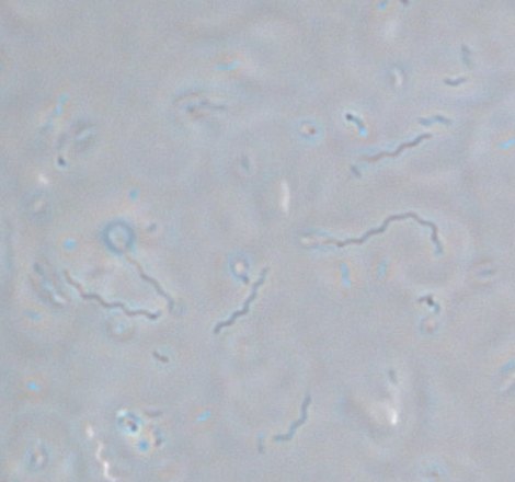 Campylobacter fetus (Nativpräparat, 1000fach)