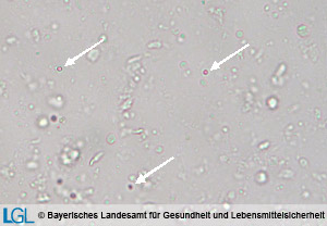 Abbildung 1: Mikroskopische Aufnahme von Kryptosporidien aus dem Kälberkot (Flotationspräparat).