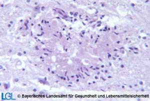 Abbildung 1: Mikroskopische Aufnahme des Gehirnes eines abortierten Rinderfetus mit Herden untergegangenen Gewebes.