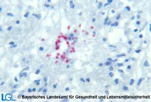 Abbildung 3: MMikroskopische Aufnahme des Gehirnes eines abortierten Rinderfetus mit immunhistologischem Nachweis von Neospora caninum-Tachyzoiten.