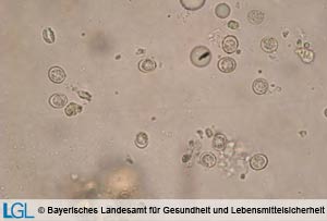 Abbildung 1: Oozyste von Toxoplasma gondii im Flotationspräparat.