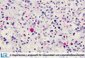 Abbildung 2: Lunge eines Hundes mit immunhistologischem Nachweis von Toxoplasma gondii-Tachyzoiten.