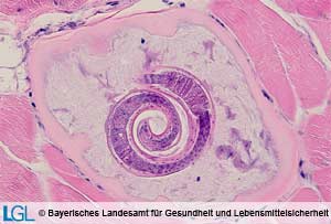 Trichinenlarve im histologischen Schnitt.