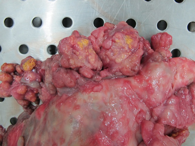 Lungenlymphknoten eines Rindes mit Tuberkulose; es sind zahlreiche verkalkte Entzündungsherde zu erkennen.