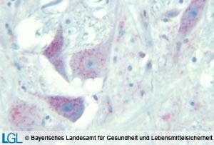 Mikroskopische Aufnahme eines Gehirnes eines Geparden mit immunhistologischem Nachweis von Prionprotein.&#xD;&#xA;