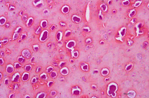 Abbildung 2 zeigt das histologische Bild der Pockenvirusinfektion aus Abbildung 1 in 630-facher Vergrößerung bei Anwendung einer HE-Färbung; es sind zahlreiche Viruseinschlusskörperchen im Hornmaterial zu sehen.