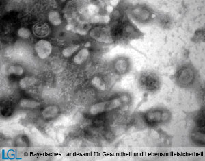 Elektronenmikroskopische Aufnahme von Orthomyxovirus-Partikeln im Negativkontrast. Die behüllten, unregelmäßig geformten und teilweise fadenförmigen Virionen besitzen einen Durchmesser von 80 bis 120 nm. Auf der Oberfläche sind Projektionen (sog. spikes) erkennbar, die aus den Strukturproteinen Haemagglutinin und Neuraminidase bestehen.