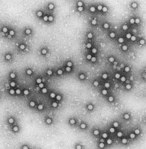 Elektronenmikroskopische Aufnahme des MKS-Virus