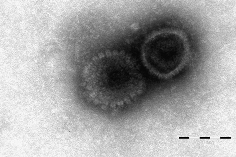 Elektronenmikroskopische Darstellung der BoHV-2-Viruspartikel aus der Probe der erkrankten Kuh