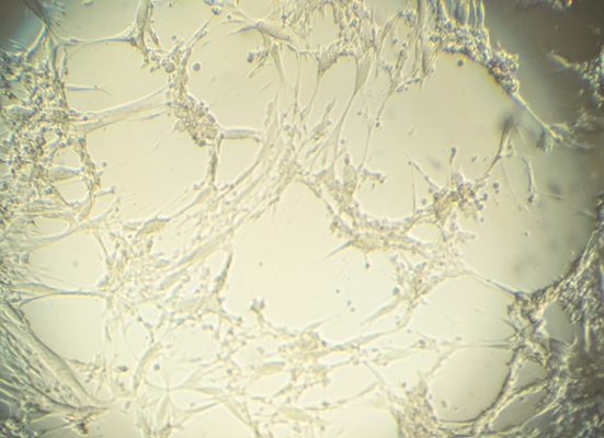 Durch Wachstum von BoHV-2 verursachter Herpesvirus-typischer, zytopathogener Effekt auf KOP-R-Zellkultur