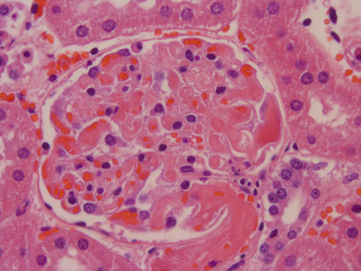 Kaninchenniere unter dem Mikroskop: mikroskopische Aufnahme, Hämatoxylin-Eosin-Färbung, 630fache Vergrößerung